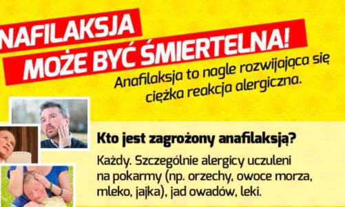 Przygotuj się na wstrząs w pojazdach komunikacji miejskiej