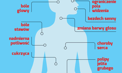 Akromegalia: jak rozpoznać chorobę?