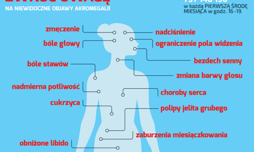 AKROMEGALIA – GDY DOROSŁY ZACZYNA ROSNĄĆ