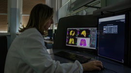 Synapse 3D ułatwia zarządzanie diagnostyką pacjentów podczas pandemii COVID19 Zdrowie, BIZNES - Szpital uniwersytecki w Pizie wykorzystuje Synapse 3D do poprawy zarządzania diagnostyką pacjentów podczas pandemii COVID19.