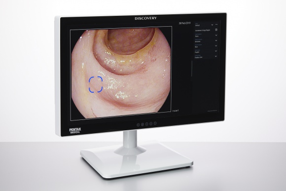 Sztuczna inteligencja wspiera leczenie raka jelita grubego Zdrowie, BIZNES - PENTAX MEDICAL DISCOVERY™, rozwiązanie wspierające walkę z rakiem jelita grubego, teraz dostępne także w Europie, Afryce i na Bliskim Wschodzie oraz na niektórych rynkach regionu Azji i Pacyfiku.